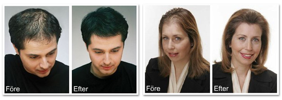 Toppik � f�re och efter