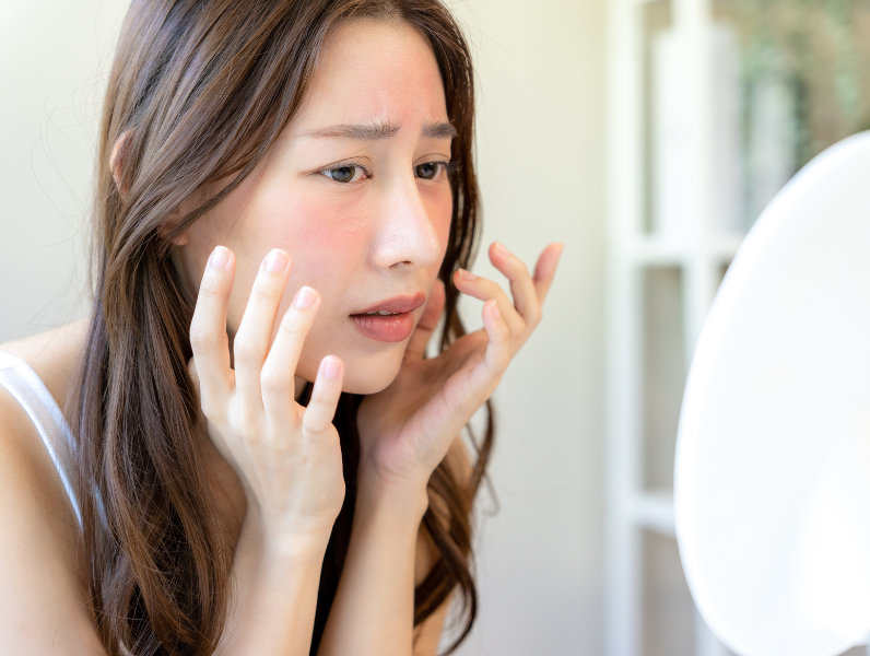 Känslig hud – så lugnar du huden och stärker dess motståndskraft