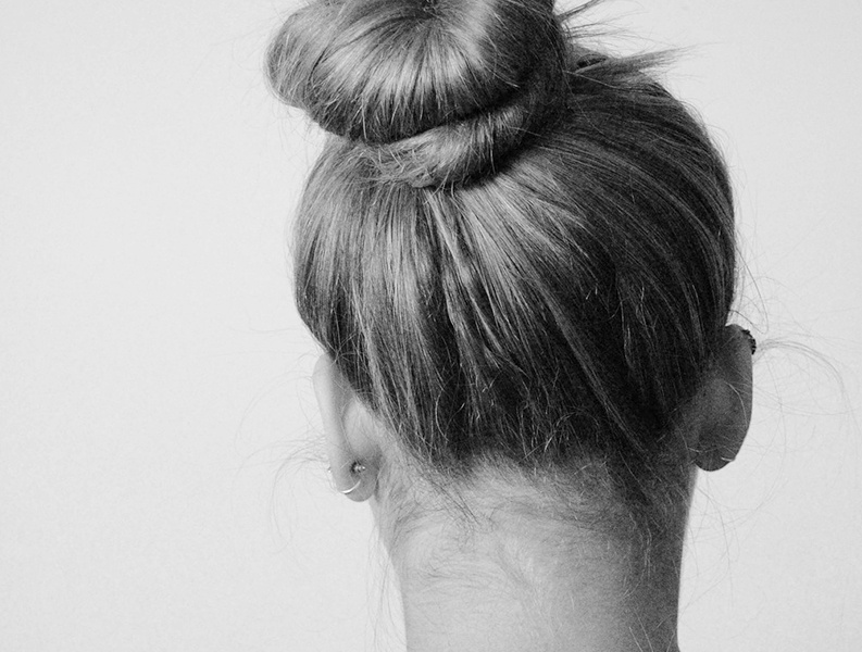 Obalanserad hårbotten