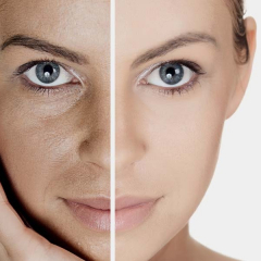 Injektionsbehandlingen PRP