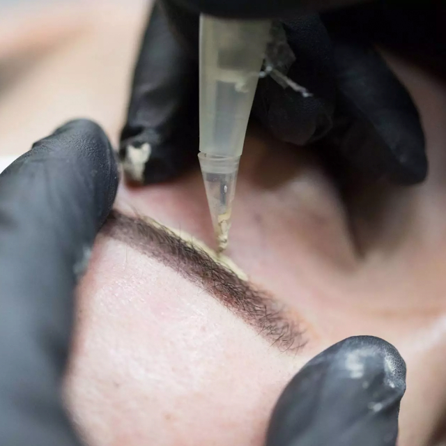 Kosmetisk tatuering - korrigering av en gammal tatuering