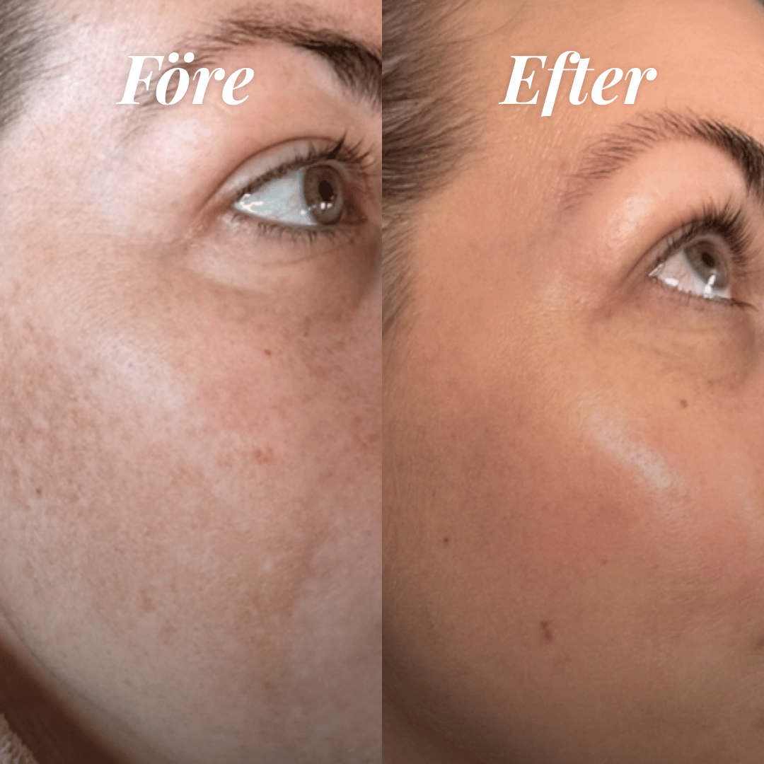 Beautypedia Sofies Pigmentresa