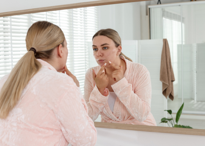 finnar runt munnen och hakan