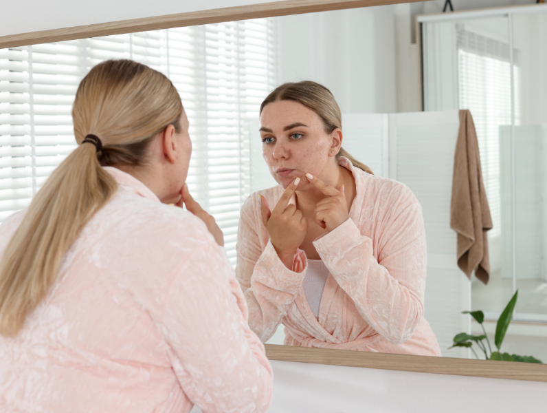 Hur blir jag av med finnar runt mun och haka?