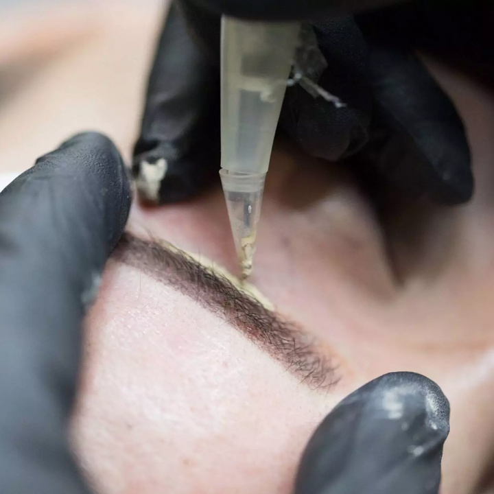 Kosmetisk tatuering - korrigering av en gammal tatuering